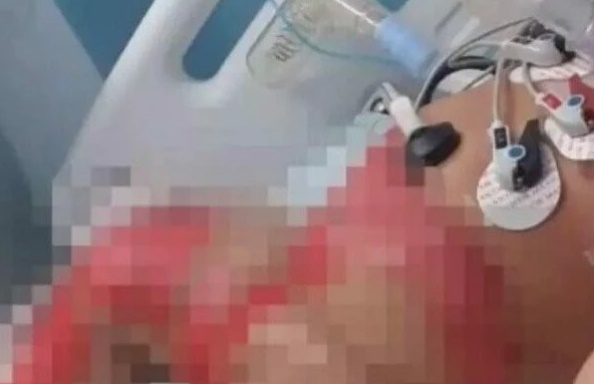Foto: Reprodução