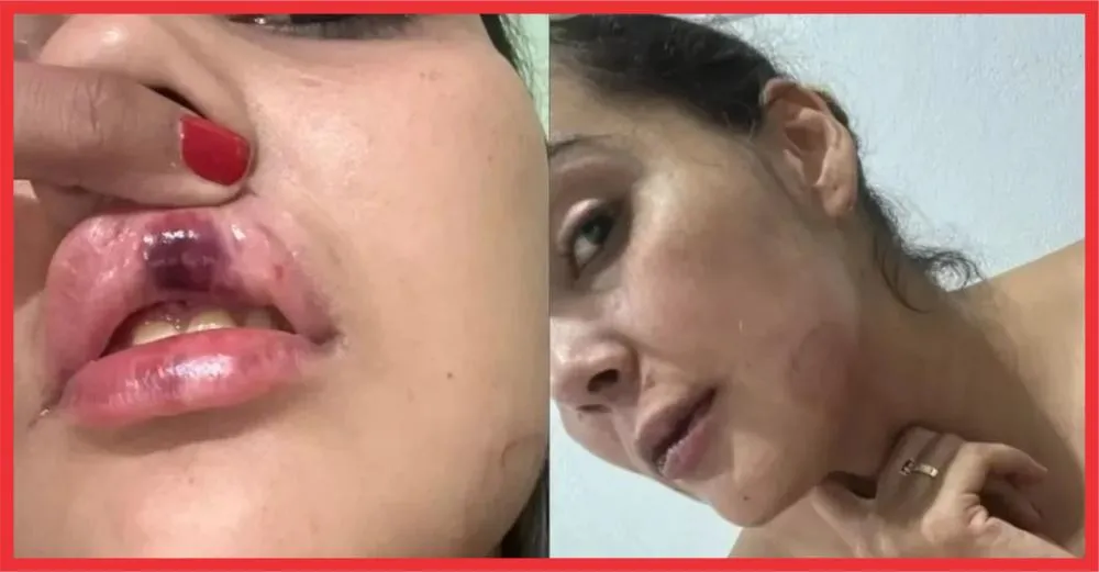 Foto: Reprodução