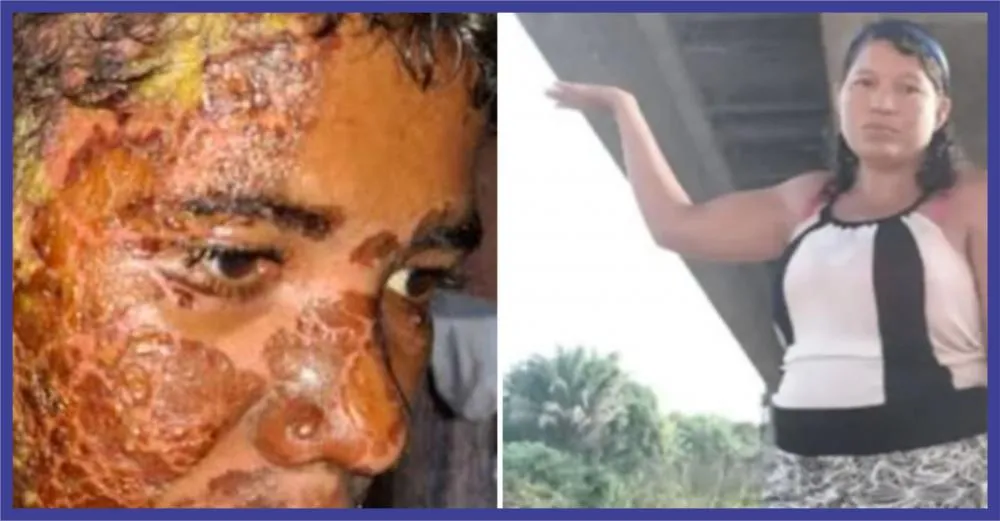 Foto: Reprodução