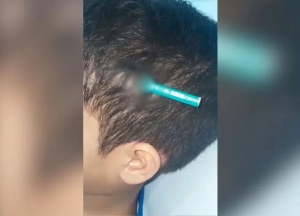 reprodução